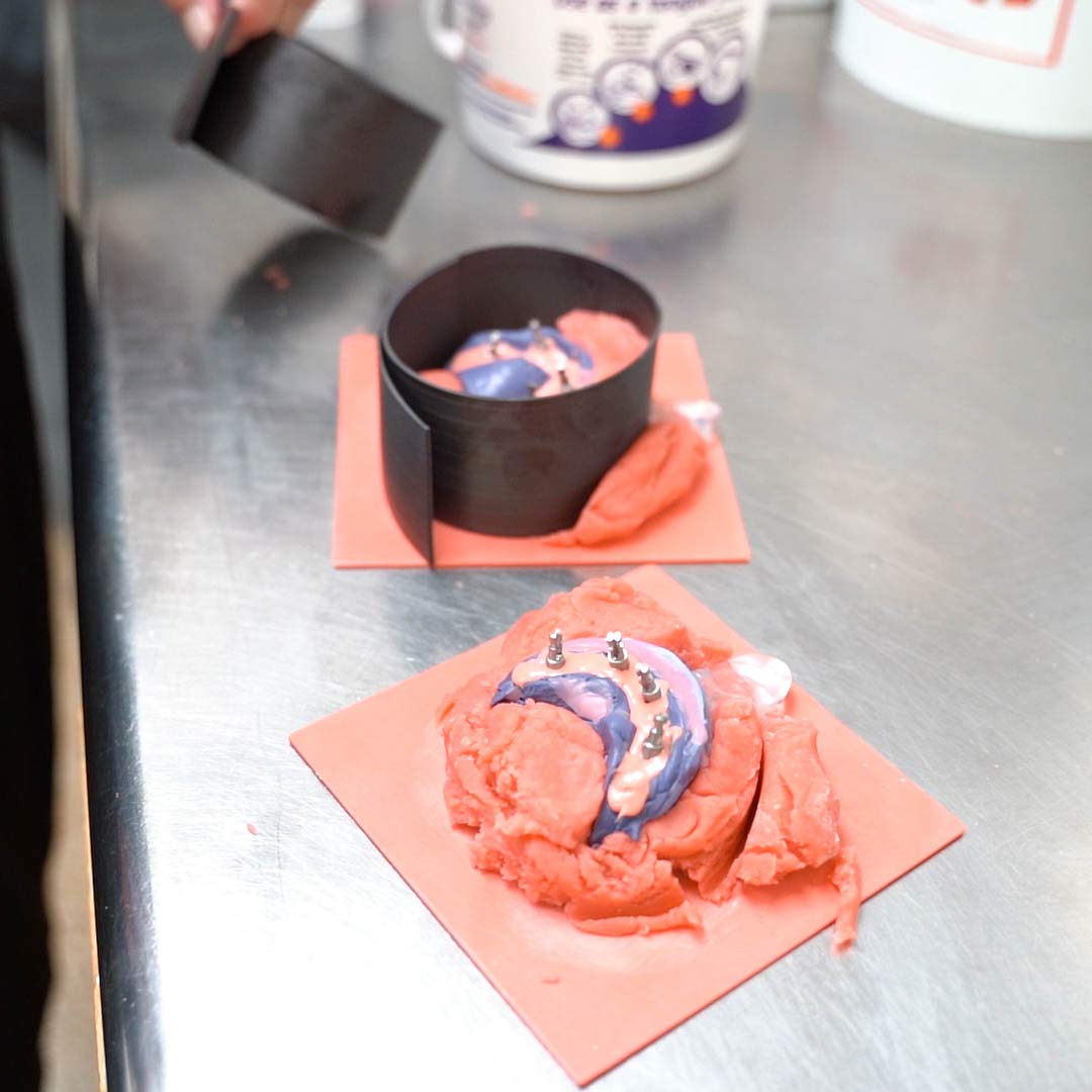 Dental Lab Trays Or Impressions