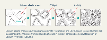 Ceraseal Bioceramic Sealer, Includes; 2g Pre-mixed syringe × 1EA Intra canal tips × 10EA