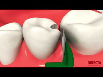 Directa Dental FenderMate Assortment Kit, 72Pcs (4x18) with Organizer Container #602770